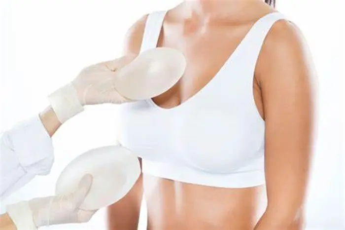 Breast surgery