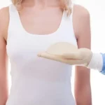 Breast surgery