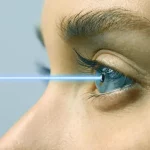 Eye Surgery10 (2)