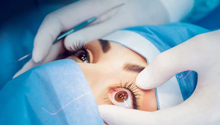 Eye surgery