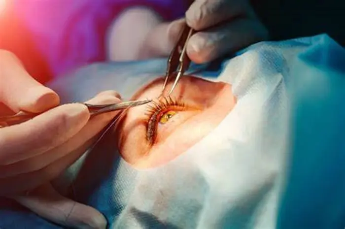 Eye surgery