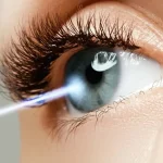 Eye surgery