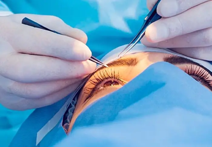 Eye surgery7