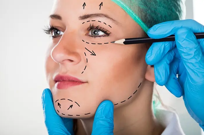 Facial surgery