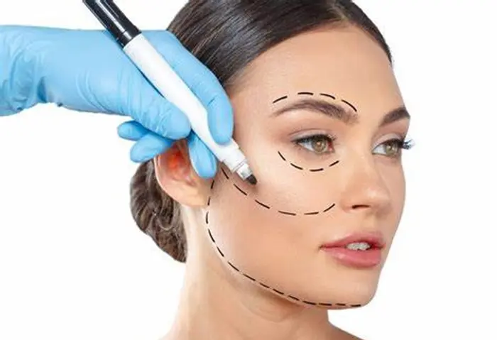 Facial surgery