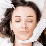 Facial surgery