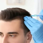 Hair Transplant