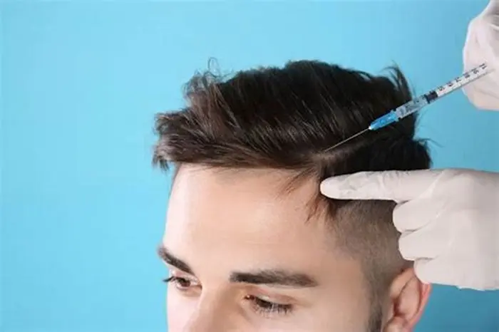 Hair Transplant