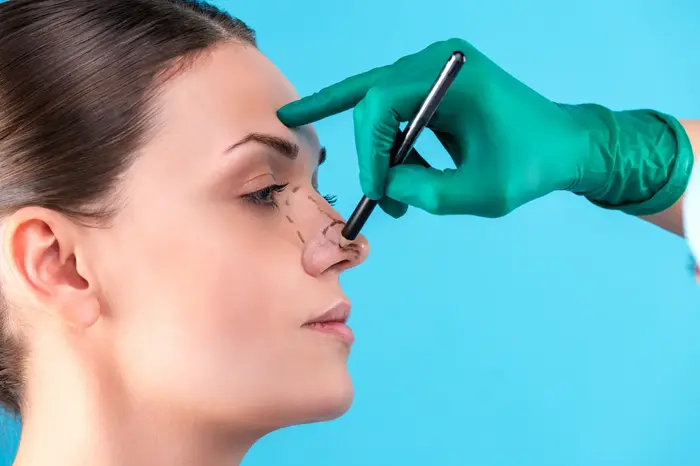 Rhinoplasty1