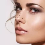 Rhinoplasty25