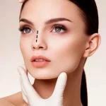 Rhinoplasty27