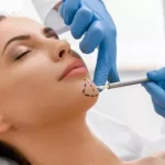 Facial surgery4