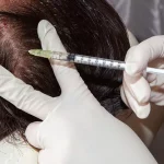 Hair Transplant24